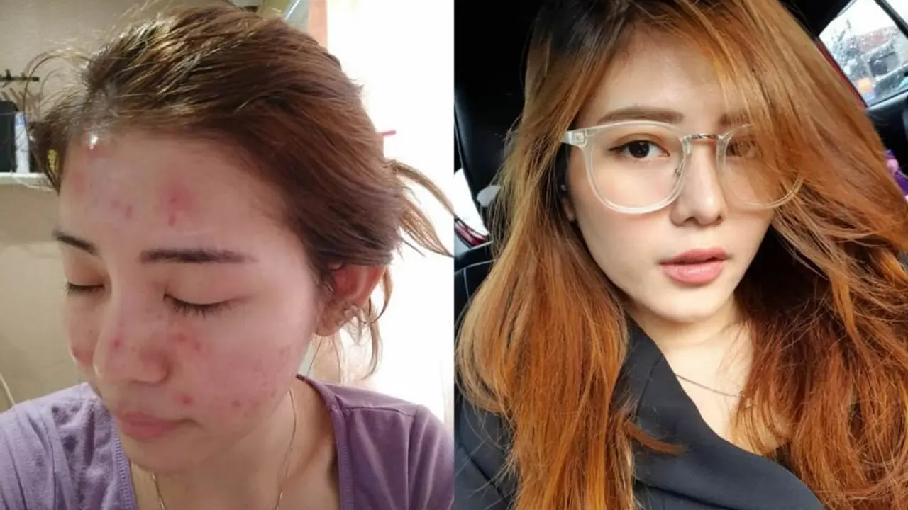 Mulai Merintis Bisnis, Youtuber Cantik Ini Buka Brand Skincare Solcare