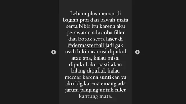 Nora Alexandra Bantah Wajahnya Lebam Karena Dipukul, Beber Fakta Sesungguhnya