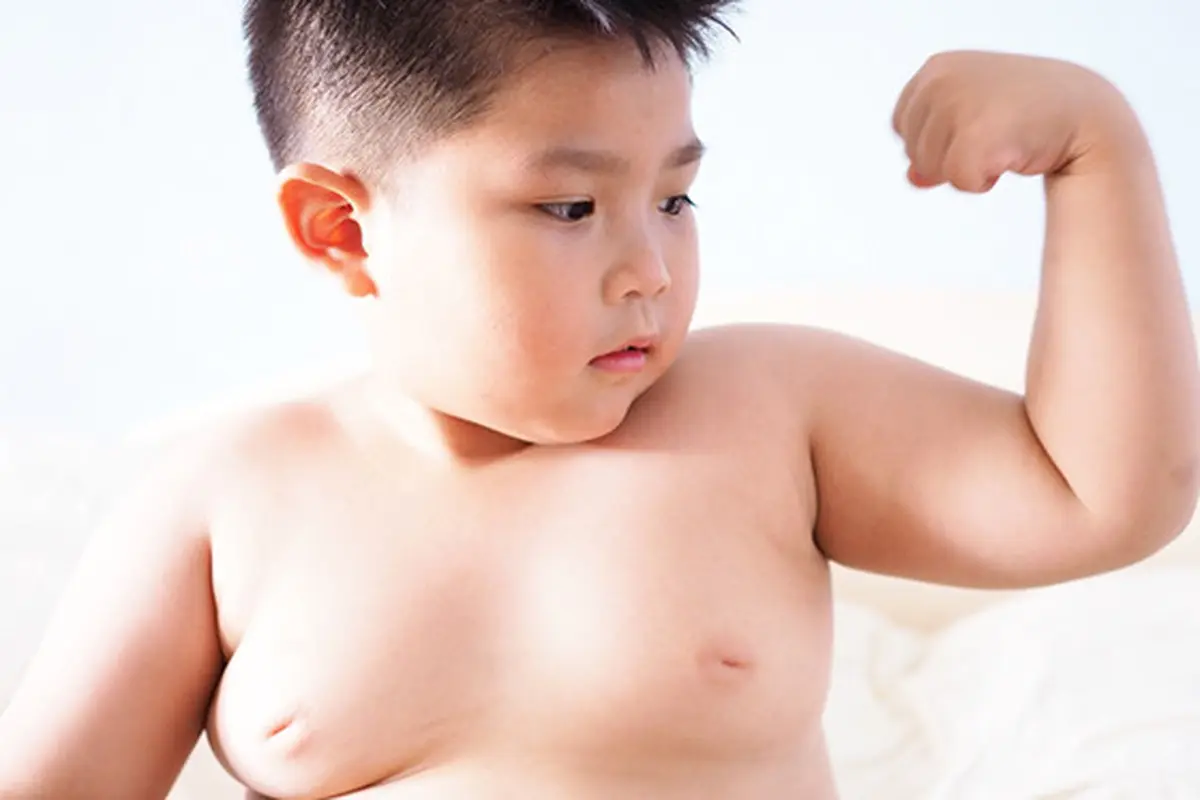 3 Cara Untuk Mencegah Obesitas Pada Anak