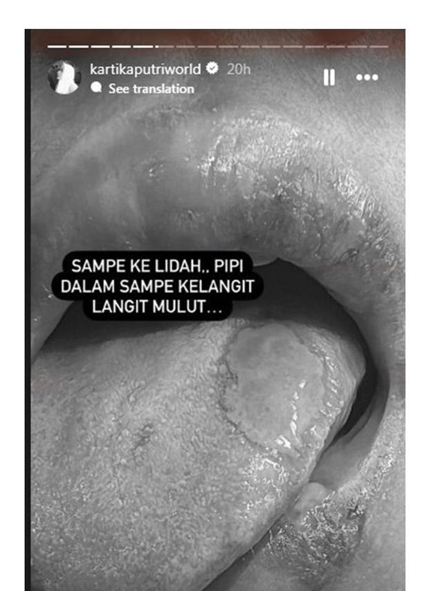 7 Potret Kartika Putri Jalani Pengobatan di Singapura, Ungkap Idap Penyakit Misterius