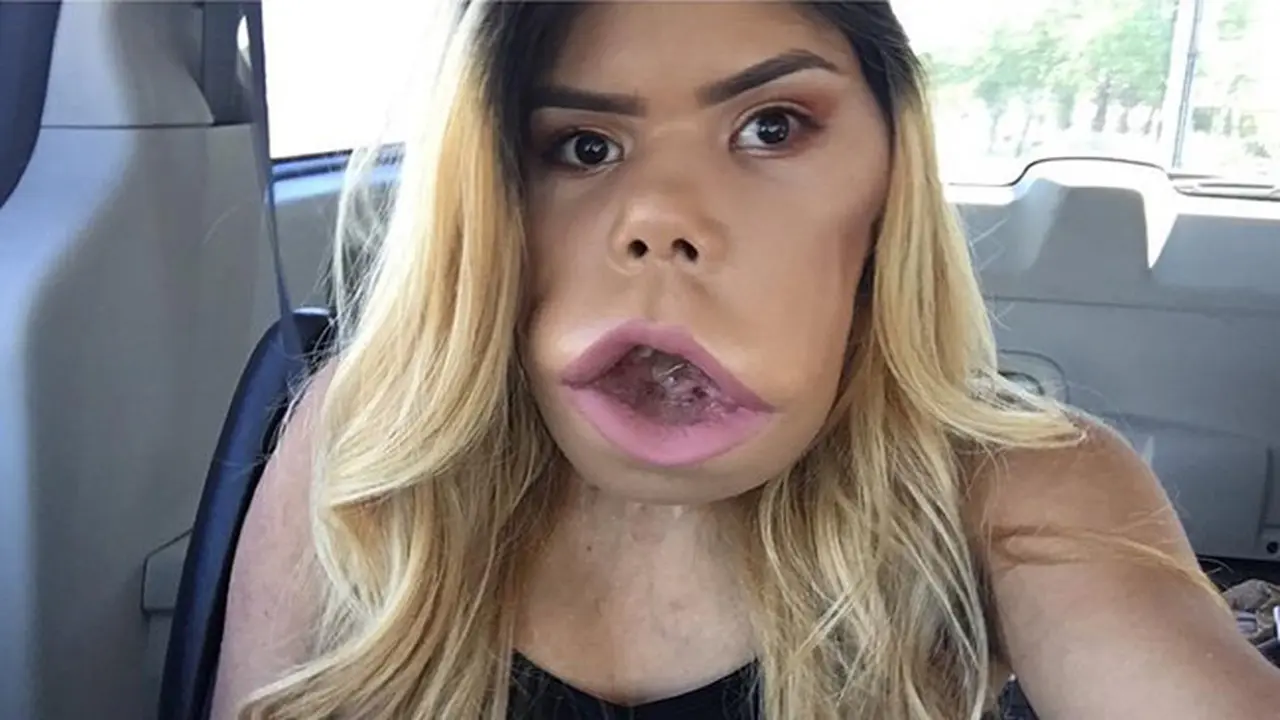 Meski Wajahnya Cacat, Wanita ini Sukses Jadi Beauty Blogger