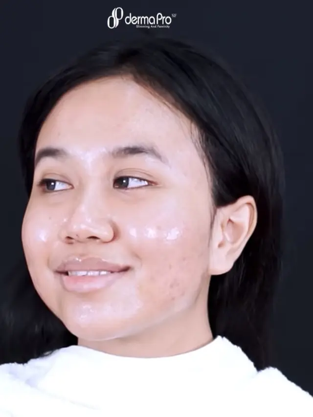 Makin Glow Up, Ini 6 Momen Mayang Perawatan Wajah Rp 80 Juta
