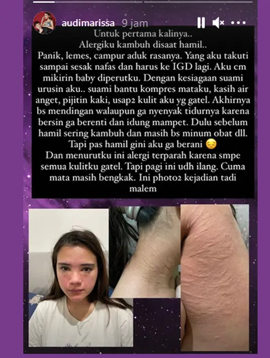 Audi Marissa (Instagram/audimarissa)