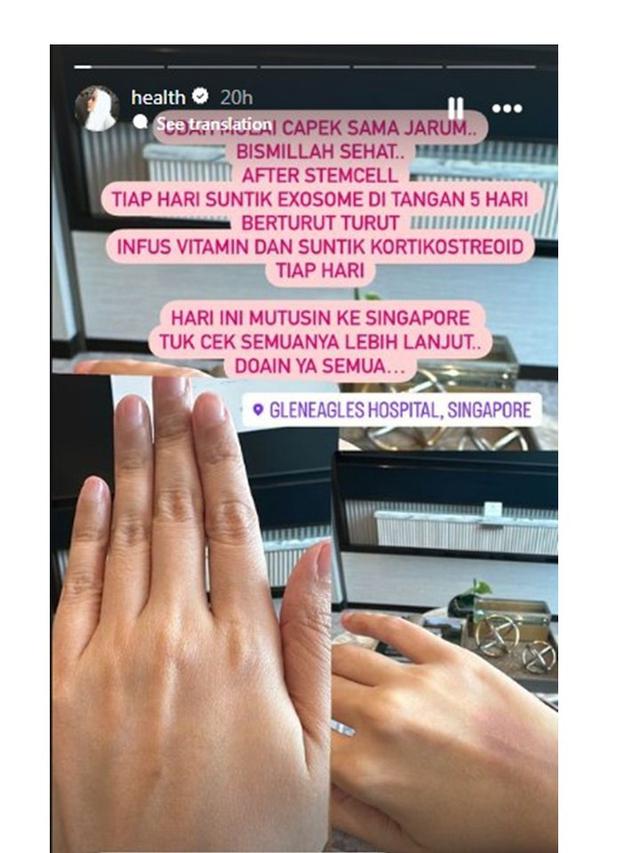 7 Potret Kartika Putri Jalani Pengobatan di Singapura, Ungkap Idap Penyakit Misterius