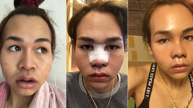 Perubahan Drastis Wanita Seksi Ini Dari Kecil Hingga Dewasa Bikin Kita Syok