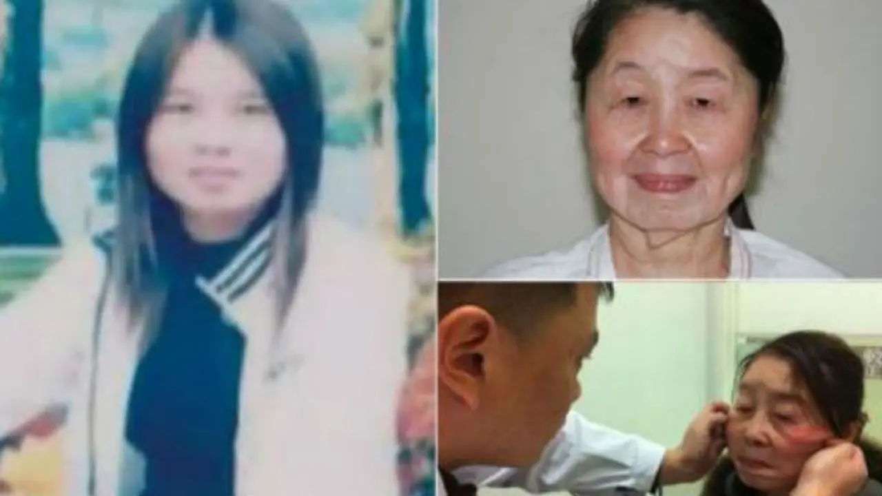 Usia 29 Tahun, Tapi Wanita Ini Seperti Nenek