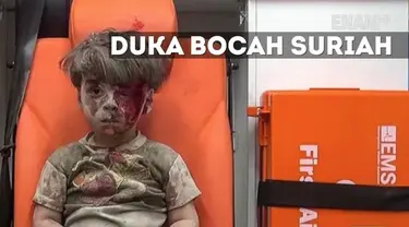 Dunia berduka, setelah beredar video Omran Daqneesh, 5 tahun, korban serangan udara di Aleppo, Suriah. Tubuhnya diselimuti debu dengan luka di dahi saat Ia diselamatkan dari reruntuhan bangunan. 