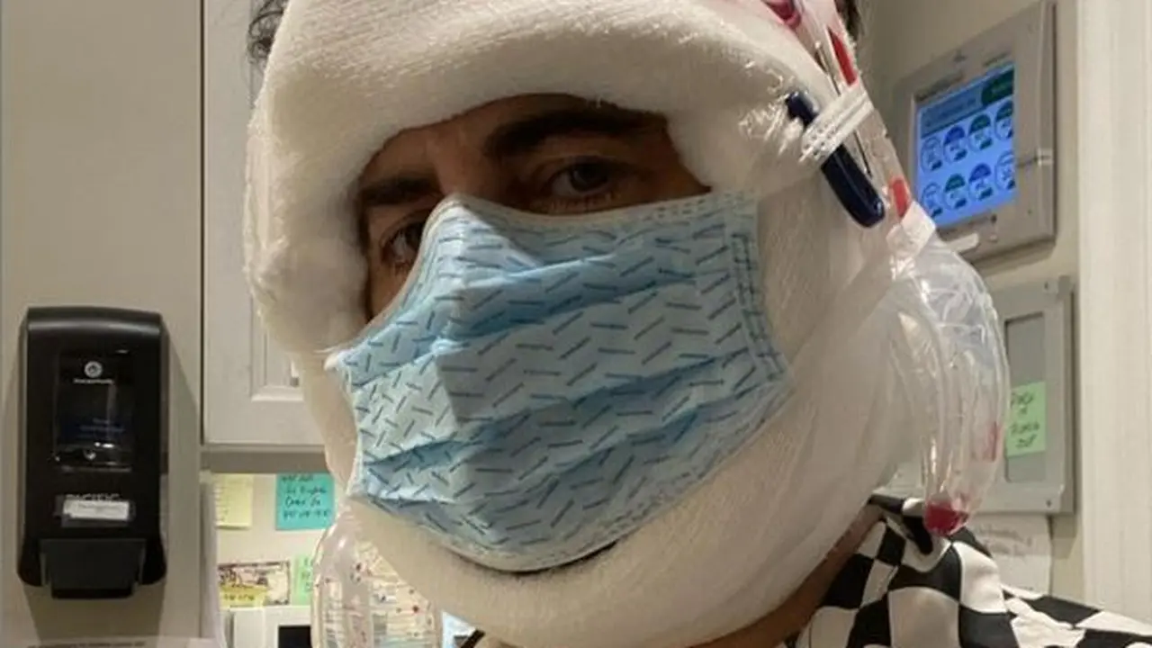 Marc Jacobs Swafoto dengan Wajah Berbalut Perban Usai Facelift