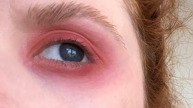 Sunburn Makeup, Tren Riasan Teranyar yang Wajib Dicoba