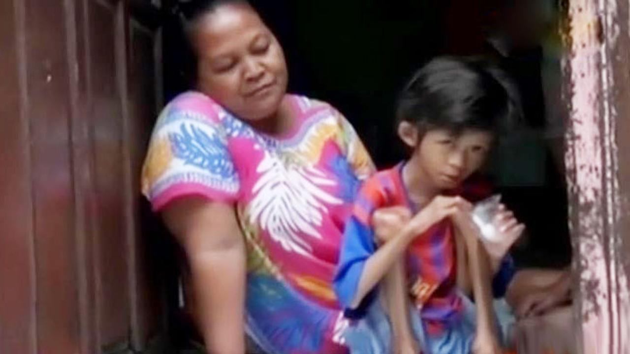 Bocah Yatim Piatu Kurang Gizi Ini Butuh Uluran Tangan