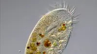Amoeba dilihat dari mikroskop. (Liputan6.com/Wikimedia Commons/Picturepest)