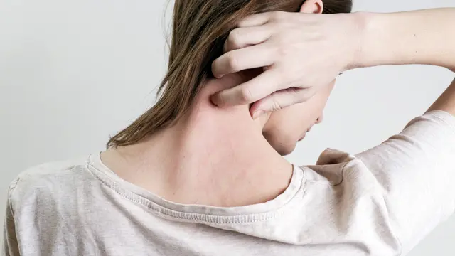 Penyakit Psoriasis