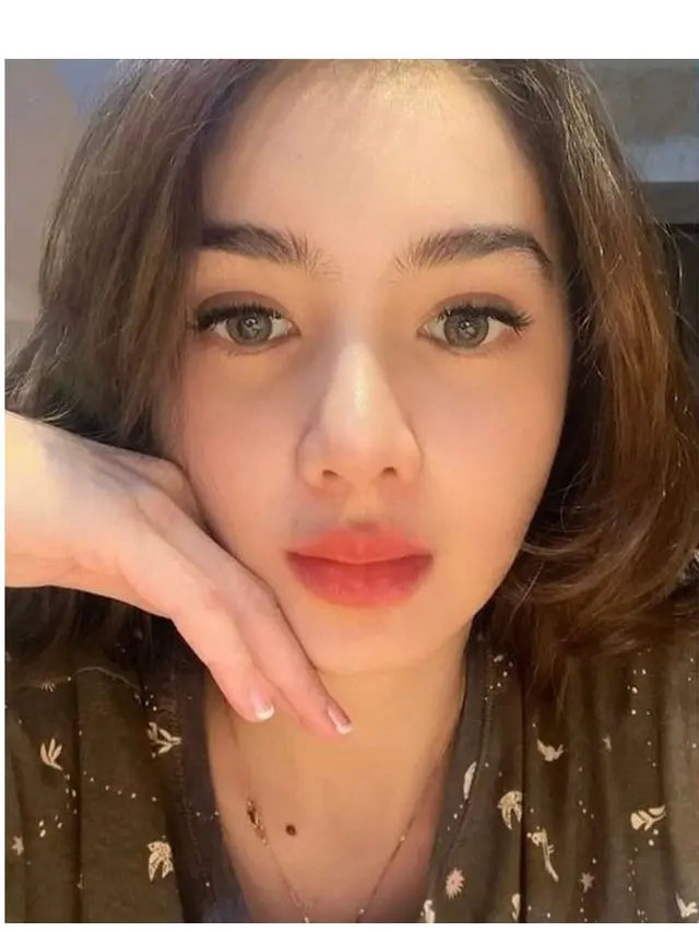 8 Potret Angel Karamoy Sebelum vs Setelah Operasi Plastik, Hasilnya Disebut Natural