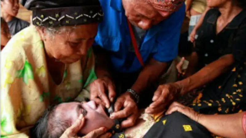 Ritual Unik Potong Gigi Wanita Sebelum Menikah di NTT