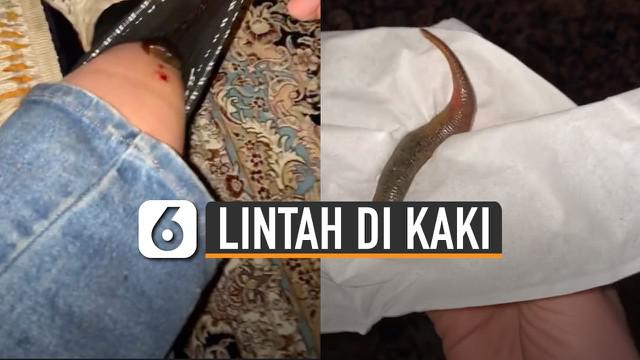 Berita Lintah Hari Ini Kabar Terbaru Terkini Liputan6 Com