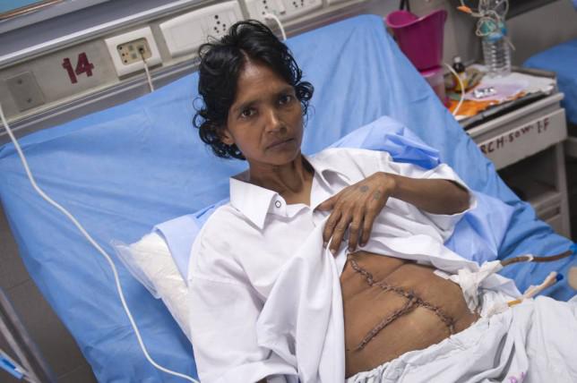 Nunwati Devi, wanita 30 tahun yang memiliki tumor seberat 17 kg | Photo: Copyright metro.co.uk