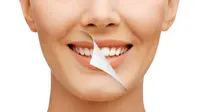 Cara Memutihkan Gigi Tanpa Efek Samping