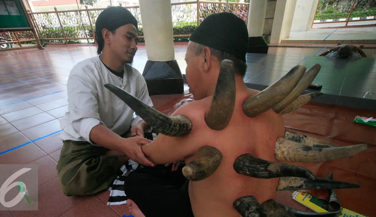 Terapi bekam tanduk memiliki fungsi yang sama juga dengan bekam biasa, yaitu mengeluarkan racun tubuh melalui darah kotor yang disedot keluar melalui media tanduk kerbau yang dipanaskan, Yogyakarta, Minggu (17/4). (Liputan6.com/Boy Harjanto)