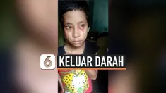 vertical keluar darah