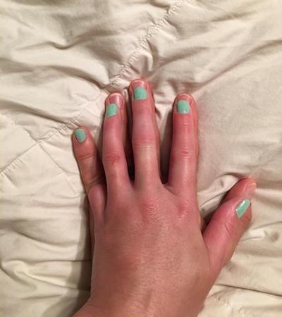Libby kini 'punya' jari kelingking baru. | Foto: copyright womansday.com