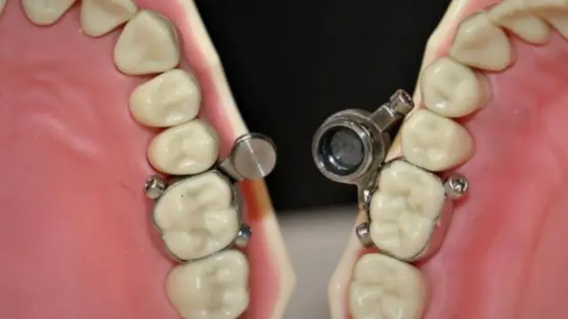 alat penurun berat badan dari magnet