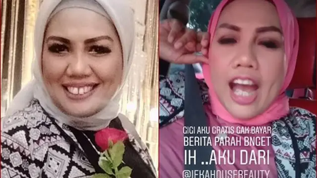 Beda Gaya Ely Sugigi Sebelum Vs Sesudah Potong Gigi (sumber: instagram/ellysugigi_real_)