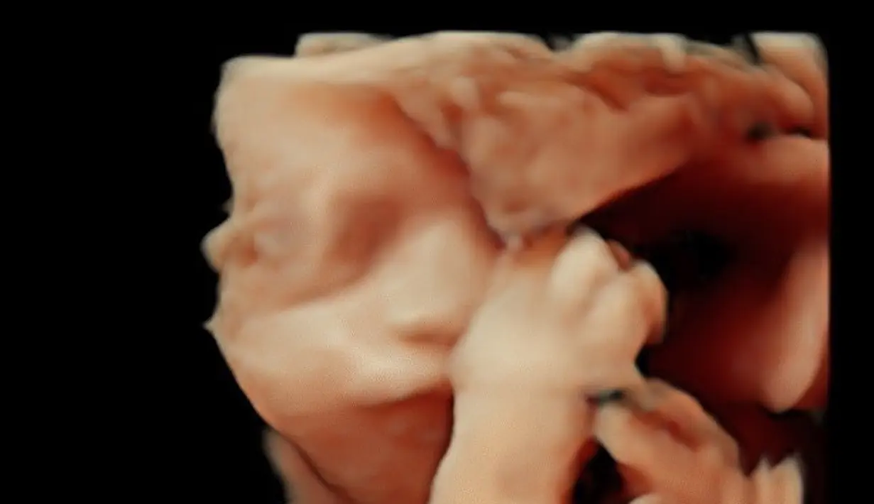 Vebby Palwinta (Instagram/Vebby Palwinta)