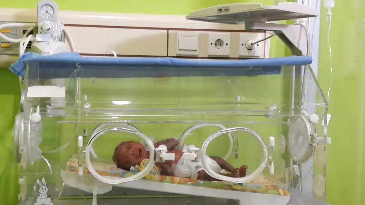 Bayi Pengidap Harlequin, Setiap Bergerak Kulit Terkelupas