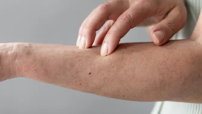 Kulit Sering Kering? Begini Cara Menjaganya agar Tetap Lembap