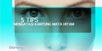 5 Tips Mengatasi Kantung Mata Hitam