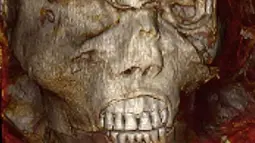 Gambar selebaran yang dirilis oleh Kementerian Pariwisata dan Purbakala Mesir pada 17 Februari 2021 menunjukkan pemindaian 3D dari kepala mumi raja Mesir kuno Seqenenre Taa II. Firaun Seqenenre Taa II dijuluki "Pemberani". (Egyptian Ministry of Antiquities/AFP)