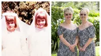 Terlahir sebagai kembar yang identik, kedua wanita ini selama 23 tahun kenakan baju yang serasi. Sumber: nypost