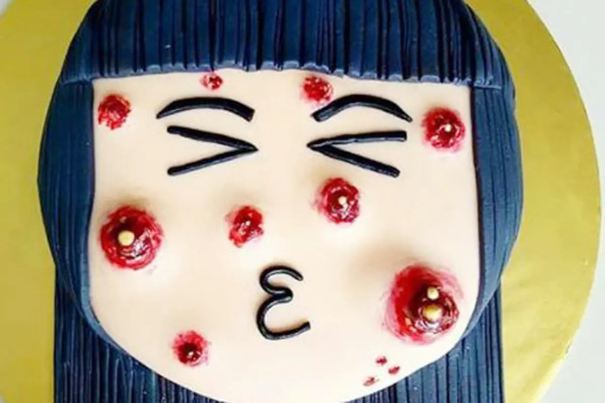 Cake Jerawat, Kue Unik yang Bikin Geli Sekaligus Penasaran