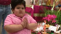 Rishi, Balita 4 Tahun yang Turunkan Berat Badan dengan Operasi