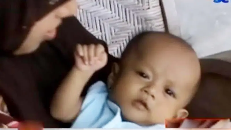 VIDEO: Bayi di Sragen Terlahir dengan Kelainan Saluran Empedu