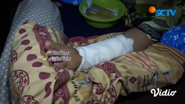 Alami Kecelakaan Hingga Diperban, Ini 6 Potret Kondisi Rohimah Mantan Istri Kiwil
