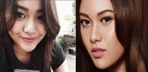 Tahi Lalat Raib, Aurel Hermansyah Makin Cantik.