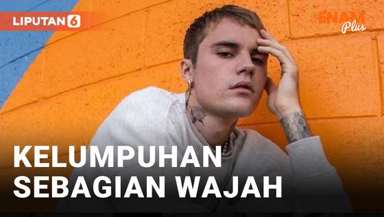 VIDEO: Justin Bieber Alami Kelumpuhan Sebagian Wajah, Semua Konser dibatalkan
