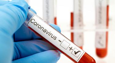virus corona covid-19