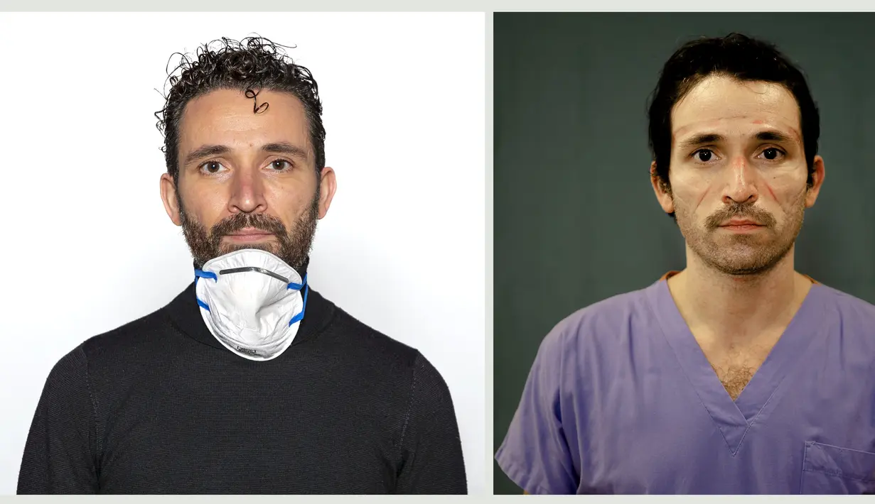 Ahli elektrofisiologi Luca Tarantino berpose untuk potret di rumah sakit Humanitas Gavazzeni di Bergamo, Italia pada 27 Maret 2020 (kanan) dan pada 30 November 2020. Lebih dari delapan bulan Luca menjadi salah satu pahlawan medis yang berjuang membantu pasien COVID 19. (AP Photo/Antonio Calanni)