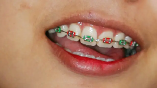 Behel