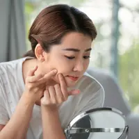 Buah sirsak mampu mengobati jerawat. (Foto: Freepik/makistock)