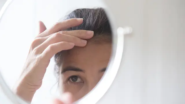 Saatnya Waspada, Ternyata Ini Tanda Rambut Rontok yang Nggak Normal