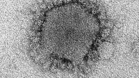 Virus MERS (MERS-CoV) (Credit: CDC/ Cynthia Goldsmith, Azaibi Tamin)