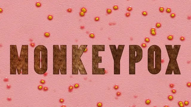 Monkeypox