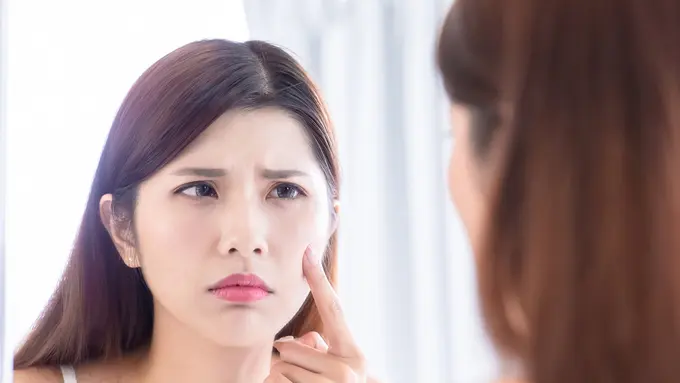 Bekas Jerawat Nggak Kunjung Pudar? Mungkin Ini yang Kulitmu Butuhkan