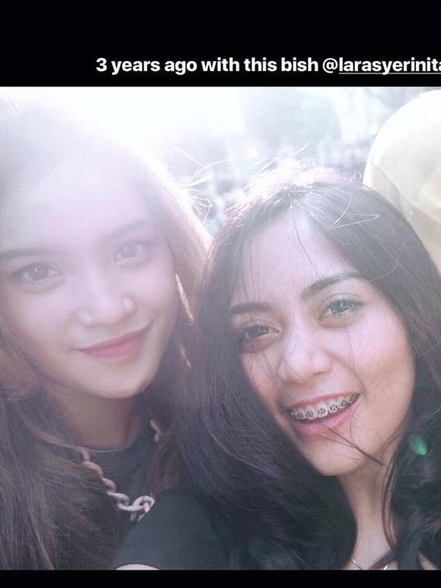 6 Foto Lawas Masa Remaja Rachel Vennya, Bikin Pangling