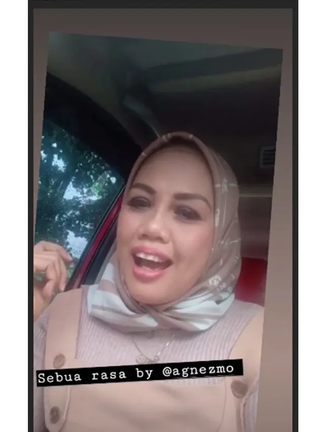 6 Potret Terbaru Ely Sugigi Setelah Lakukan Potong Gigi, Banjir Pujian