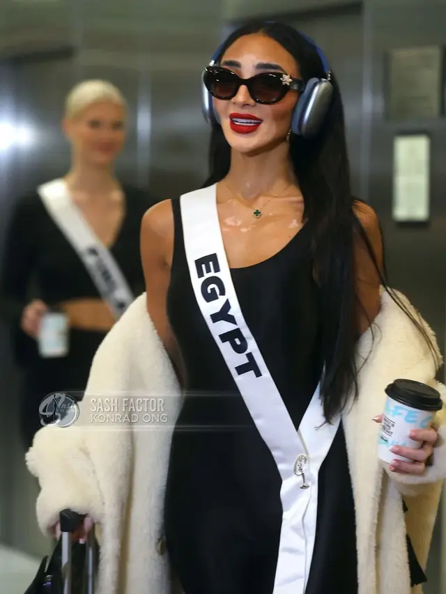 Wakil Mesir Jadi Kontestan Miss Universe 2024 Pengidap Vitiligo Pertama, Sempat Tutupi Kondisi Kulitnya