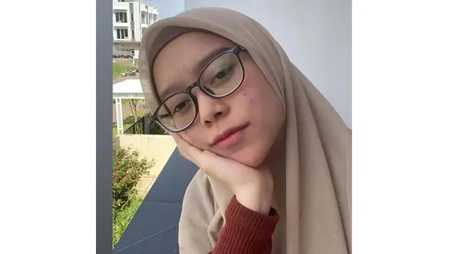 6 Seleb Ini Pernah Unggah Foto saat Wajah Berjerawat, Akui Tak Malu